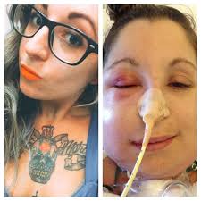 Fundraiser for Cory Leone by Sarah Bsocks : grossly expensive medical costs