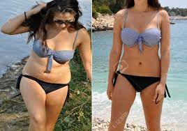 本物のビキニ姿の女性の体の重量損失の写真の前後に。素人アマチュア前に、と後の写真、自然、スリミング製品を広告の例示として使えるの写真素材・画像素材  Image 73368590