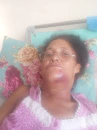 AGRESIÓN EN EL COTORRO: MUJER TERMINA CON FRACTURA DE MANDÍBULA Una señora  fue salvajemente golpeada en el Reparto Lotería, municipio Cotorro en La  Habana, por un hombre identificado como Luis Sosa. La