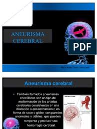 Um rompimento de aneurisma pode ser fatal ou levar a. Aneurisma Cerebral Gravedad