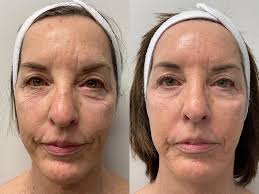 Audrey Sams•CAE (@aesthetics_by_audrey) • Instagram photos and videos