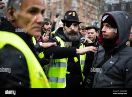 Blessures aux yeux Banque de photographies et d'images à haute résolution