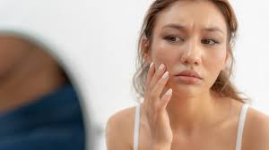 Da xỉn màu là gì? Nguyên nhân và cách làm sáng da bị xỉn màu