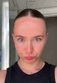 Lauren Forehead Love Island