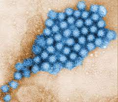 Norovirus, the genus of a number of species of virus, family caliciviridae, causing human gastroenteritis, of which. Norovirus Doccheck Flexikon
