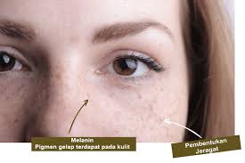 Kemudian airnya bisa langsung dioleskan pada muka yang jika ingin menghilangkan jerawat dalam waktu yang cepat, maka cara menghilangkan jerawat dengan. Punca Dan Cara Merawat Kulit Muka Jeragat Zaza Iman Lifestyle Blogger