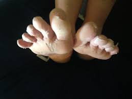 Foot injury can cause a tumor to start hurting. How To Prevent And Treat 7 Common Thru Hiking Foot Problems The Trek