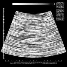 Can i get an ultrasound at 8 weeks? Ultrasound Background Free Stock Photos Rgbstock Free Stock Images Xymonau May 20 2014 30