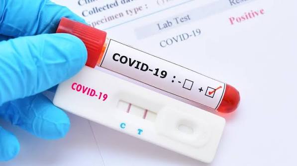COVID-19 পরীক্ষার ফলাফল বোঝা: মিথ্যা নেতিবাচক
