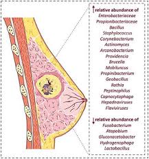 Many women with breast cancer are menopausal at the time of their cancer diagnosis, and a significant number will enter menopause during treatment. Frontiers Microbiome And Breast Cancer New Role For An Ancient Population Oncology