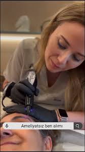 AMELİYATSIZ BEN ALIMI