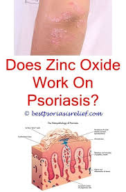Psoriasisoftheliver Denorex Psoriasis Reviews Uvb Lamp Psoriasis Psoriasis Best Topical Natural Psoriasis Remedies Psoriasis Cure Natural Cure For Psoriasis