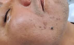 All of my videos are for actual educational purposes! Dermica Medesthetics Author At Dermica Medesthetics