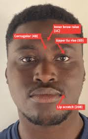 Paying attention to uncertainty: A stochastic multimodal transformers for  post-traumatic stress disorder detection using video