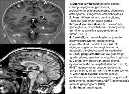 The cancer cells have leaked from a primary tumor elsewhere and have reached the brain via blood vessels or the body's lymphatic system. Childhood Brain Tumors American Academy Of Pediatrics