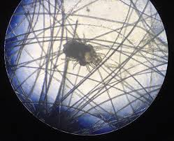 Image result for what do Mallophaga look like in dog fur