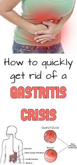 How To Quickly Get Rid Of A Gastritis Crisis Womenzoom Com Remedies For Gastritis Gastritis Diet Natural Remedies For Heartburn
