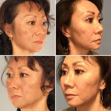 Dr. Henry Mentz (@HenryMentz)