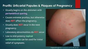 Yet no one ever talks about it. Polymorphic Eruption Of Pregnancy A K A Puppp Youtube