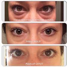 Our Eye Cream Eye Cloths Are A Deadly Duo For Crows Feet Puffiness Thin Creepy Skin A Multifunction Eye Cream Rodan And Fields Eye Cream For Dark Circles