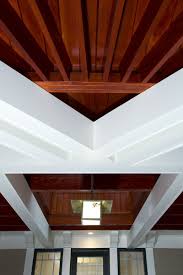 Illuminating Lighting In Your Carport Will Make It Easy To Maneuver During The Night Let Us Know Your Thoughts Kensingt Home Additions Ceiling Lights Home