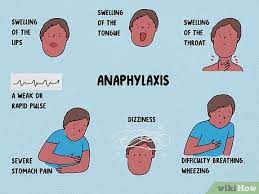 4 Ways To Recognize An Allergic Reaction Wikihow