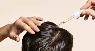Instead, headaches occur from the tension caused by these excessively straining hairstyles. Minoxidil Side Effects What Are They And Are They Common Hims