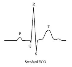 Draw a standard ECG and explain the different segments in it. - Assam Eduverse