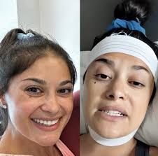 Loren Brovarnik's Upcoming Surgery and Plastic Surgery Rates