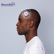 NeuroStar Advanced TMS Therapy