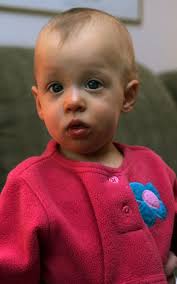 Hanselman sextuplets are teenagers