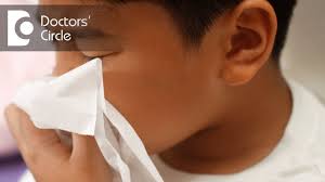 Polyps usually have a teardrop shape and a smooth surface. How To Manage Nasal Polyps In Children Dr Sreenivasa Murthy T M Youtube