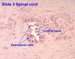 The central canal lies below and is connected to the ventricular system of the brain, from which it receives cerebrospinal fluid, and shares the same ependymal lining. They Are Ganglia And Assist Manufacture And Movement Of Ceribou Spinal Fluid Csf On Central Canal Spinal Fluid Spinal Cell