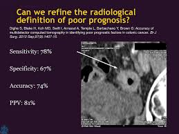 Despite the overall poor prognosis and the fact that the disease is mostly incurable, pancreatic cancer has the potential to be curable if caught very early. Sigmoid And Colon Cancer Staging Ppt Download