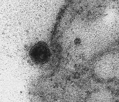 Nah, virus corona akan berusaha keras untuk membungkam jalur tersebut, sehingga virus bisa bertumbuh dengan tenang. Ini Penampakan Asli Virus Corona Saat Masuk Ke Sel Tubuh Manusia