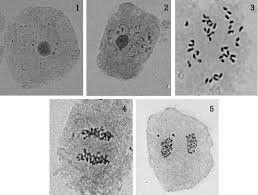 Cell division usually occurs as part of a larger cell cycle.in eukaryotes, there are two distinct types of cell division; Microscopic Images Of Chromosomes At Different Stages Of Cell Division Download Scientific Diagram