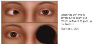 Image result for Cover Test