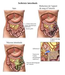Les selles blanches sont un signe clinique pouvant faire évoquer différentes maladies, parfois graves. Mucus Anal Gelee Jaune Fairedistfity Over Blog Com