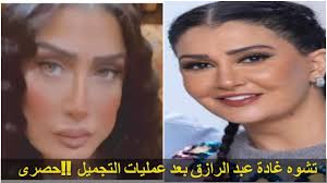 We did not find results for: ØºØ§Ø¯Ø© Ø¹Ø¨Ø¯ Ø§Ù„Ø±Ø§Ø²Ù‚ Ø¨Ø¹Ø¯ Ø¹Ù…Ù„ÙŠØ§Øª Ø§Ù„ØªØ¬Ù…ÙŠÙ„ Ø§Ù„ÙØ§Ø´Ù„Ø© Ø´ÙƒÙ„Ù‡Ø§ Ø§ØªØ´ÙˆÙ‡ ØªÙ…Ø§Ù…Ø§ Ø´Ø§Ù‡Ø¯ Ø¨Ø§Ù„ÙÙŠØ¯ÙŠÙˆ ÙˆØ§Ø¬Ø±Ù‡Ø§ ÙÙ‰ Ù…Ø³Ù„Ø³Ù„ Ø±Ù…Ø¶Ø§Ù† Youtube