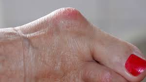 It is divided into 12 inches and equal to. 10 Common Foot Problems And How To Manage Them Everyday Health