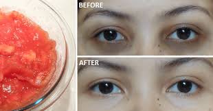 Hostile to oxidant in this oil secure skin and expel polluting influences. How To Remove Dark Circles In 3 Days