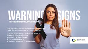 Image result for Merkel Cell Carcinoma