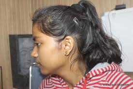 What is the treatment of malira ?