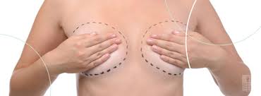Biggest & most modern plastic surgery clinic in baltic states, team of 6 plastic surgeons Breast Augmentation In Tijuana Mexico Plastic Surgery Limarp Clinic