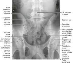 Normal Anatomy Radiology Key Radiology Imaging Medical Radiography Radiology
