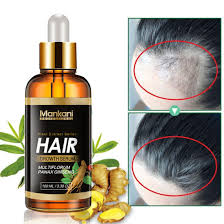 As great as these vitamins are for your hair's health, don't expect to grow a full mane overnight while taking. 100ml Men Women Hair Loss Treatment Private Label Organic Natural Herbal Care Hair Rapid Growth Oil China Hair Growth Oil And Hair Loss Serum Price Made In China Com