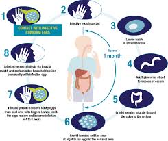 Image result for Pinworm