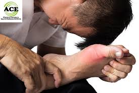 Physical therapy (pt), also known as physiotherapy, is one of the healthcare professions. Gout Treatment Alexandria Arthritis Treatment Arlington