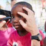 Image result for what type of treatment from a ota does a blind 5 month old receive