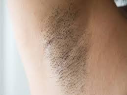 The area becomes inflamed and can become painful or irritated. Armpit Pain Common Causes And Treatments
